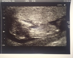 Boy or girl?
