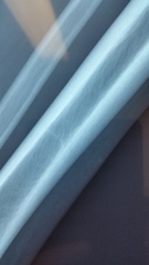 Photos!  How is this not a fracture? Any orthopods/ortho nurses around?