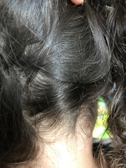 Oh god, is this nits??