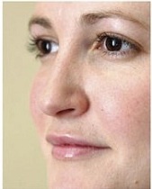 So I have booked in to have lip filler :terrified:
