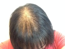 Between bootcamps support thread Summer17