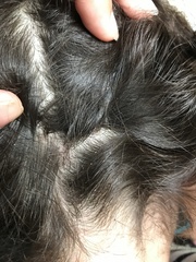 Oh god, is this nits??