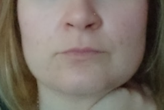 So I have booked in to have lip filler :terrified: