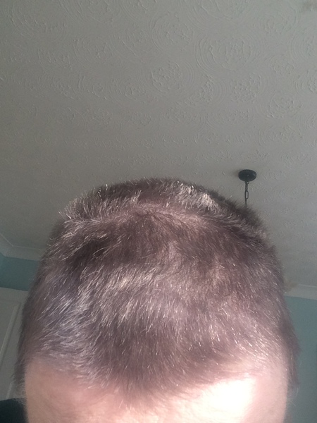 Head shave to go grey