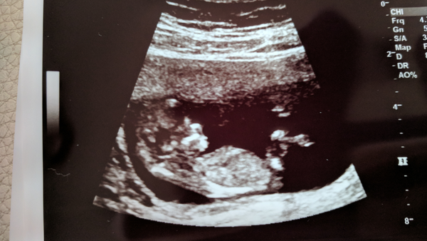 Pregnancies due April 2018 *Edited by MNHQ*