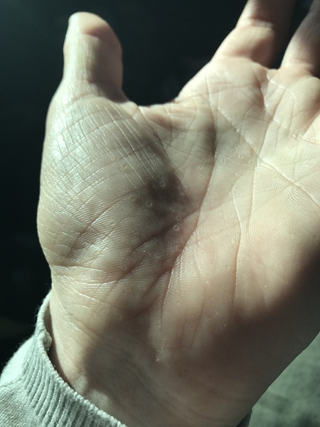 What are these on my hands please?!