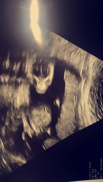 12 week scan?? Any ideas