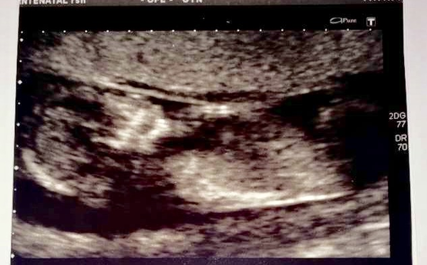 Gender Guesses?