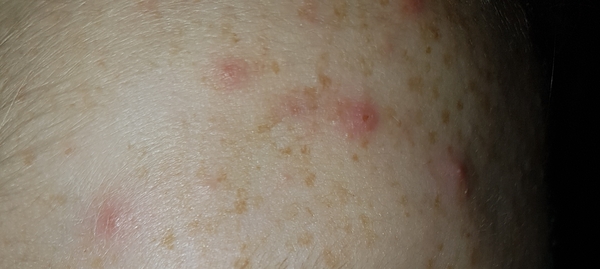 What are these spots?!