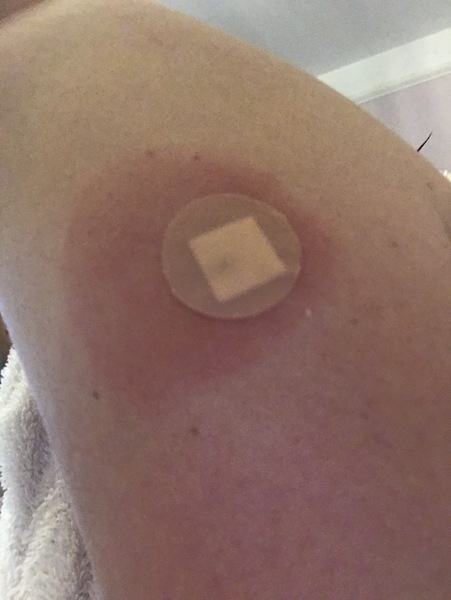 Flu jab incorrectly given