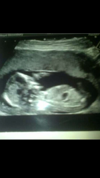 Boy or girl?? Guesses ?
