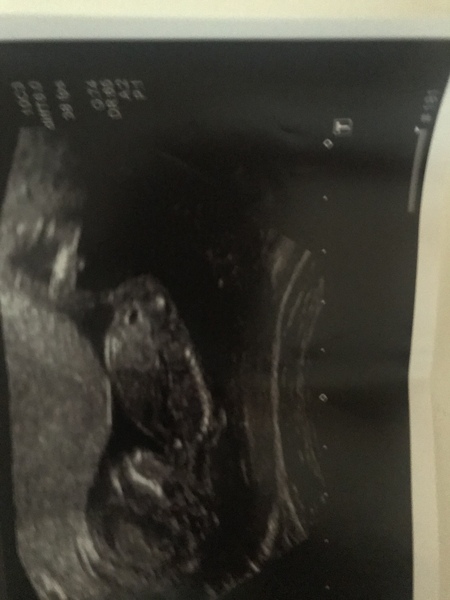 Told sex/gender @nhs dating scan, 12+4