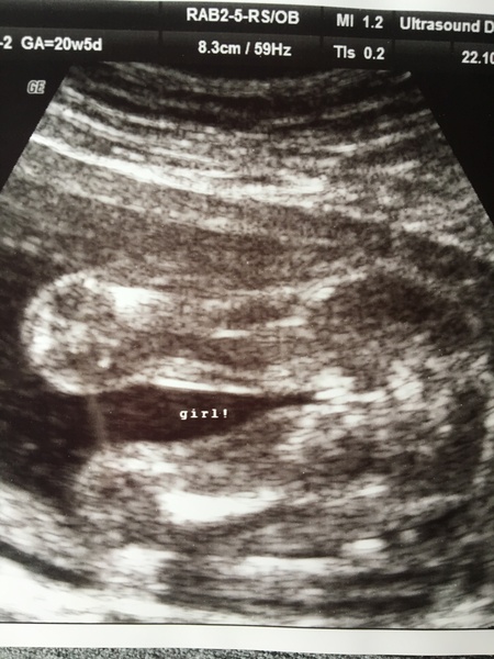 Babybond scan anyone?
