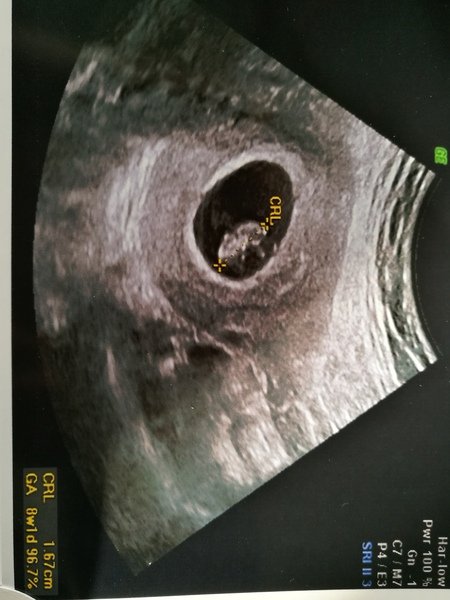 Babies due May 2018