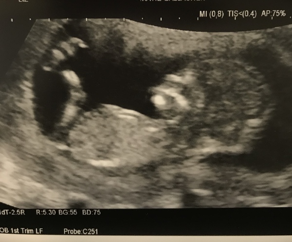 Thread no.2 for babies due April 2018