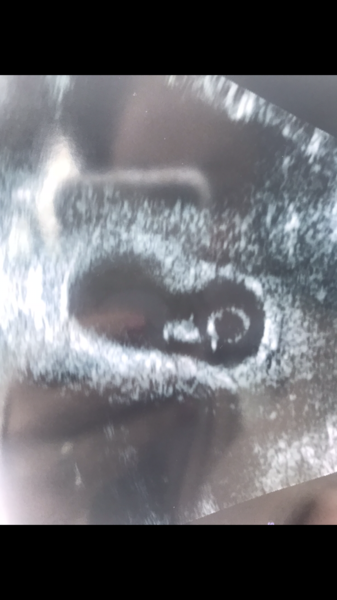 Early scan, wrong dates.