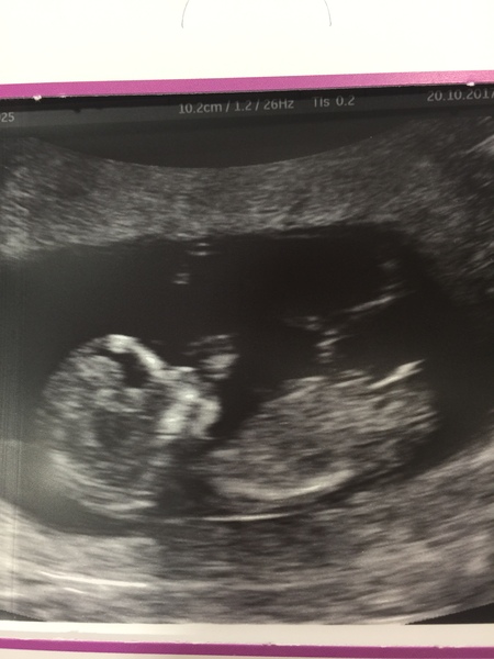 Thread no.2 for babies due April 2018