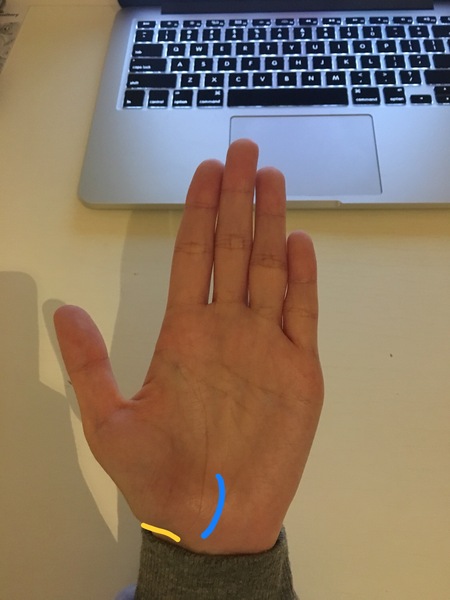 to be worried that I've fractured my hand?