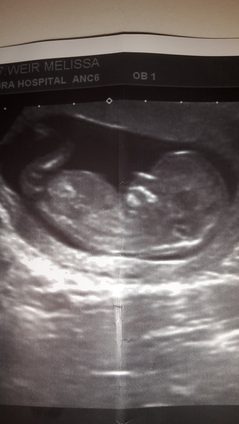 Pregnancies due April 2018 *Edited by MNHQ*