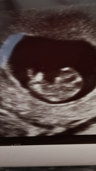 Which end is my baby's head?!