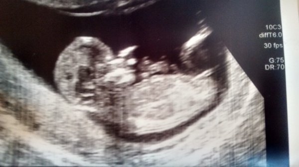 Thread no.2 for babies due April 2018