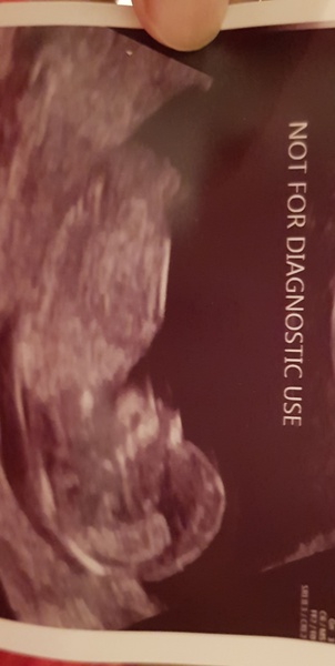 Baby boy or girl?!