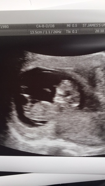 Gender guess, nub??