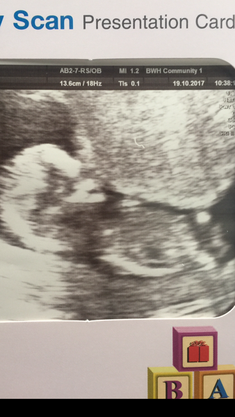 Gender guess, nub??