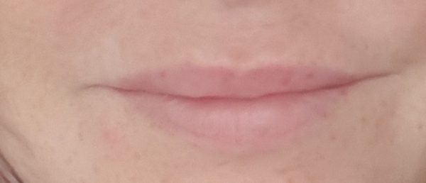 So I have booked in to have lip filler :terrified: