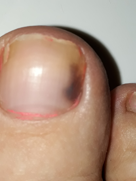 Skin cancer referral...