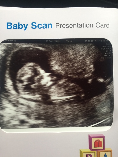 May 2018 thread 3, 12 week scans and heading towards the 2nd trimester