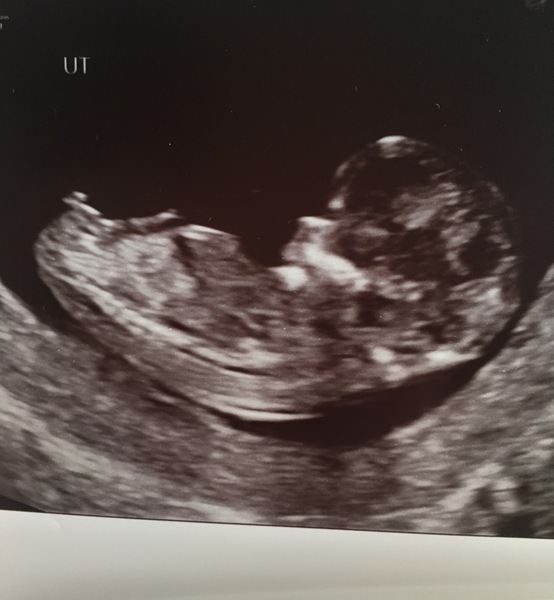 Thread no.2 for babies due April 2018