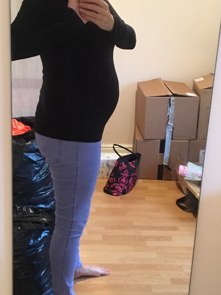 Funny shaped bump at 29w (Pic!)