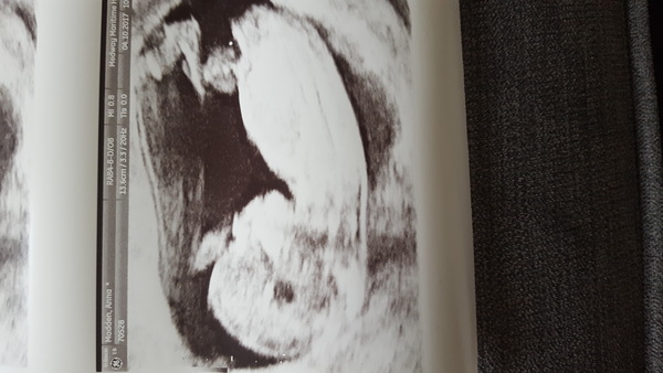 Pregnancies due April 2018 *Edited by MNHQ*