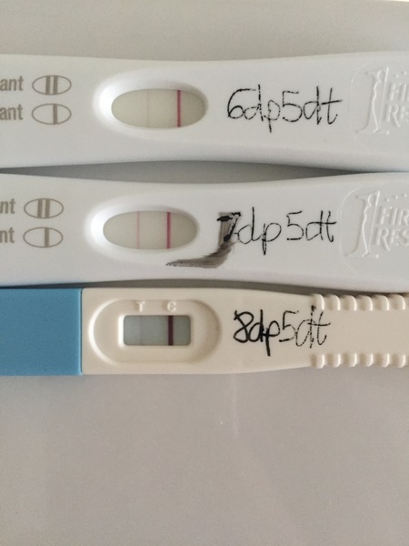 4 high quality embryos at day 3 - what should I expect at day 5?