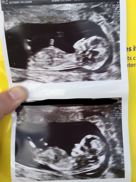 Pregnancies due April 2018 *Edited by MNHQ*