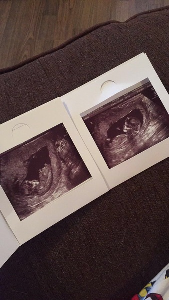 Pregnancies due April 2018 *Edited by MNHQ*
