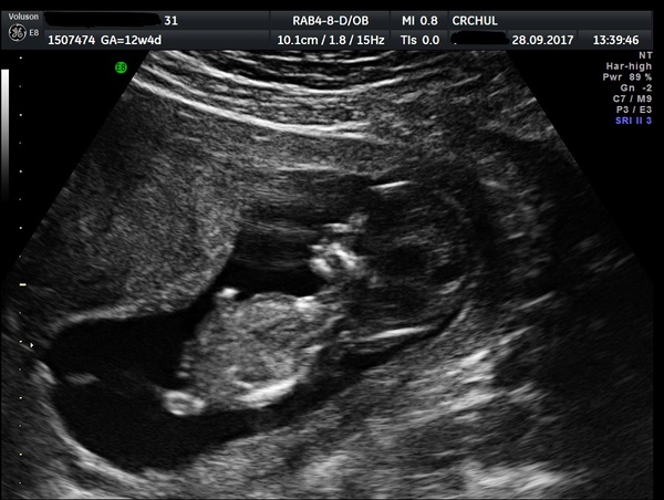 Pregnancies due April 2018 *Edited by MNHQ*
