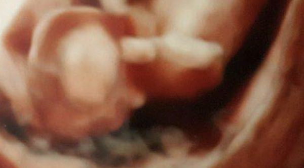Friend said baby looked like a Yorkshire pudding