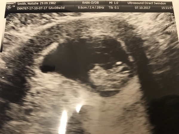 Babies due May 2018