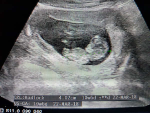 Baby boy or girl?!