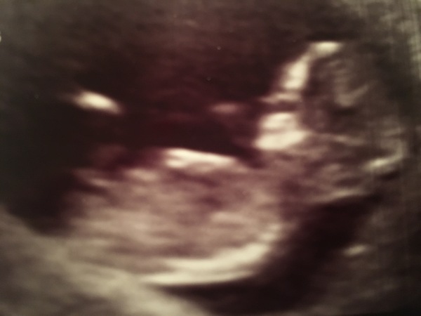 Nub Theory Guesses? :)