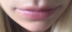 So I have booked in to have lip filler :terrified: