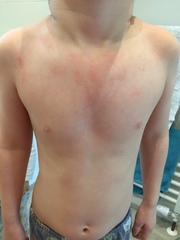Skin rash - any ideas?