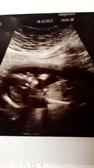 12 week scan?? Any ideas