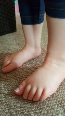 calling foot experts - are DD's feet ok?