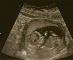 Any guesses of boy or girl?