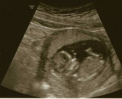 Any guesses of boy or girl?