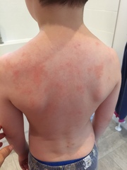 Skin rash - any ideas?