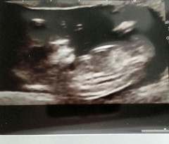 SCAN AT 14 WEEKS, Can they tell the SEX OF THE BABY ???